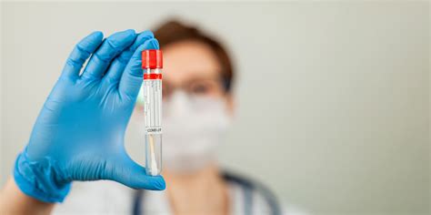 pcr test results uk